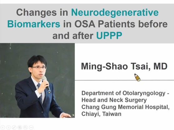 Changes in neurodegenerative biomarkers in sleep apnea patients before and after UPPP